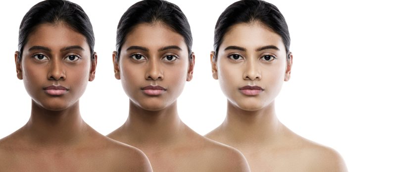 Skin Bleaching is a Symptom of a Deeper Problem | Maryoluonye.com